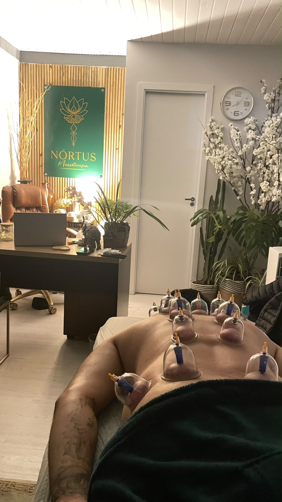 Ventosoterapia aplicada nas costas na Nórtus Massoterapia